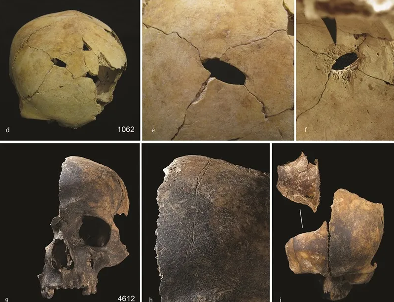 El misterioso episodio de violencia extrema que sucedió en la Edad del Bronce británica